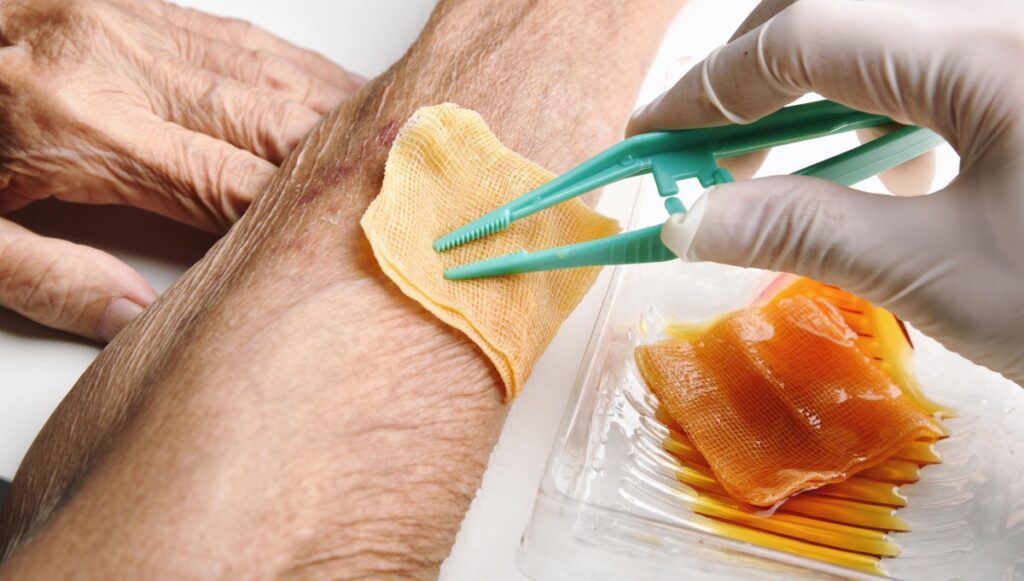 Honey As A Natural Wound Healer