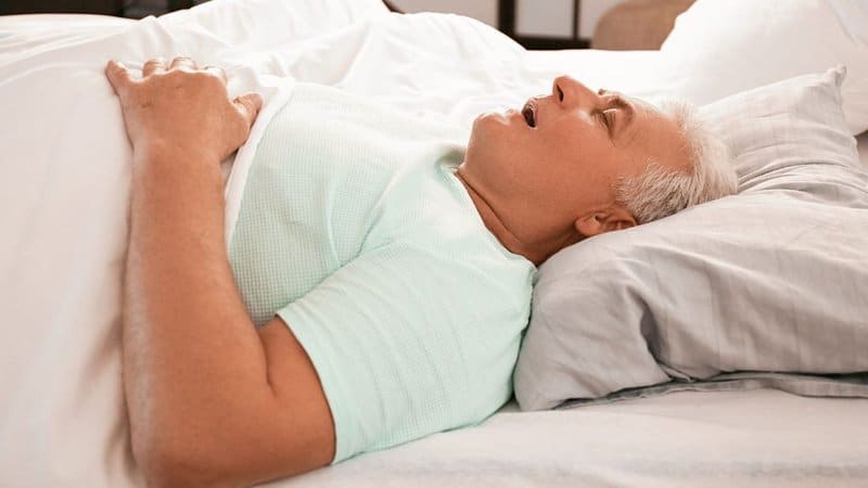 Obesity And Sleep Apnea