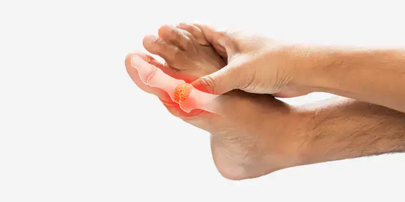 50 Daily Habits to Fight Gout Naturally